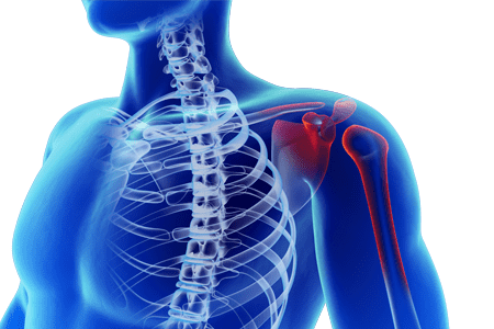 Пути повышения эффективности лечения периартрита плечевого сустав