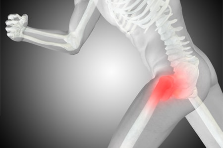 Применение магнитного поля в лечении деформирующего остеоартроза крупных суставов